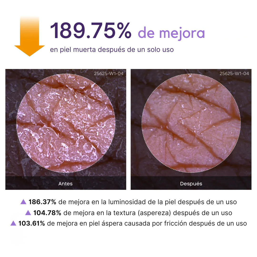 Zeyren™ - Spray aclara cualquier zona oscura