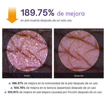 Zeyren™ - Spray aclara cualquier zona oscura