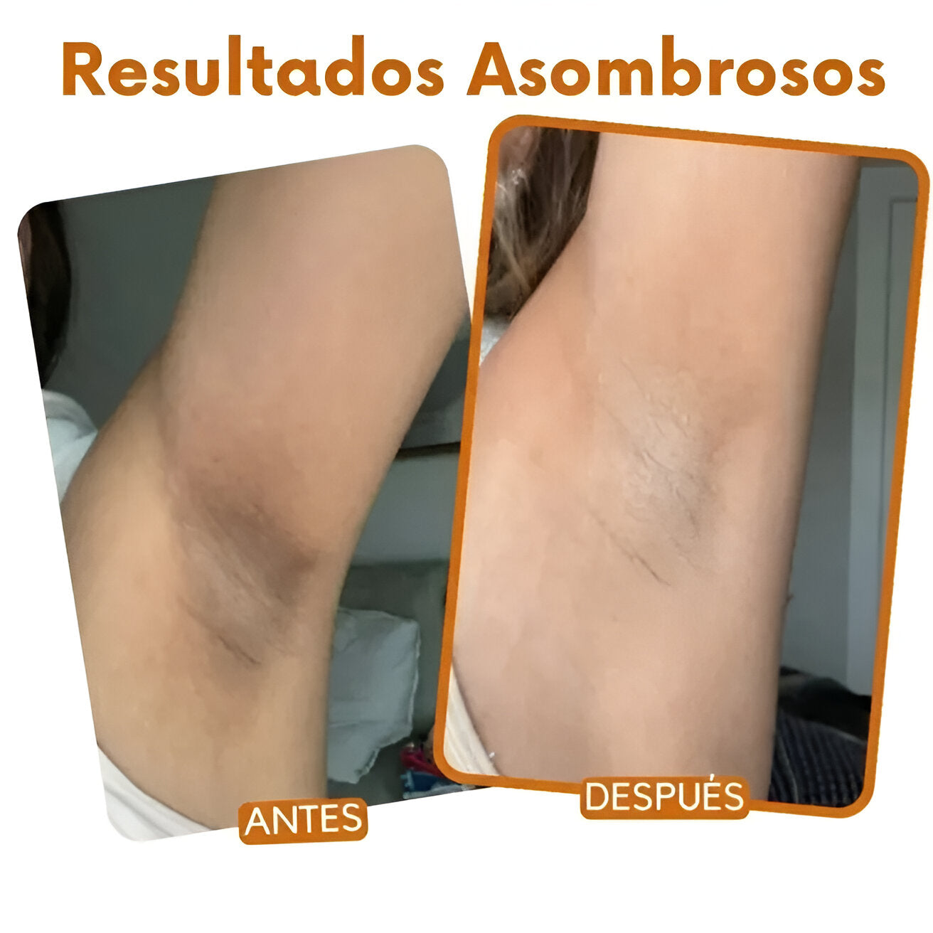 Zeyren™ - Spray aclara cualquier zona oscura