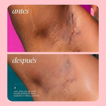 Zeyren™ - Desodorante Aclara axilas al instante